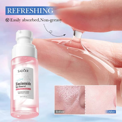 SADOER 10% Niacinamide Whitening Spot Removal Gentle Cleanser